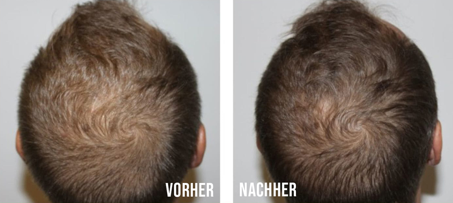 Vorher-Nachher-Vergleich