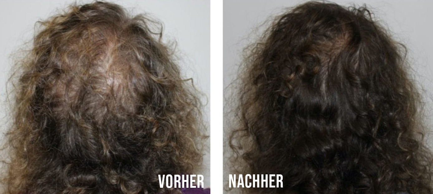 Vorher-Nachher-Vergleich
