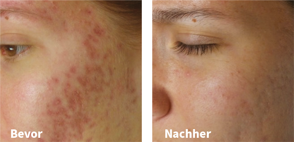 Vorher-Nachher-Vergleich